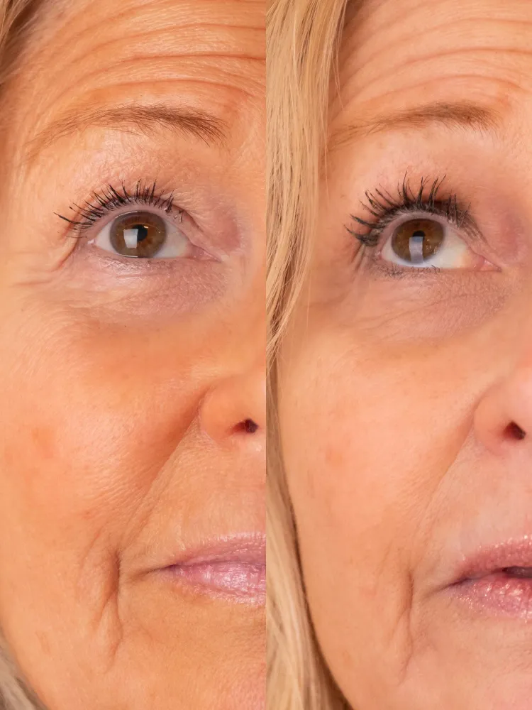 Professionell Kvalitet Eyelash Growth Serum 3